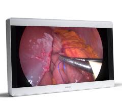 Barco Hosts Booth Talks on Medical Display Management at RSNA