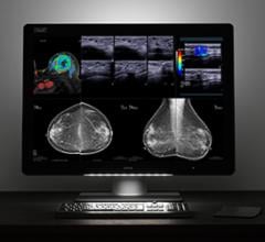 Barco Shares Latest Advances in Multimodality Diagnostic Imaging at RSNA 2017