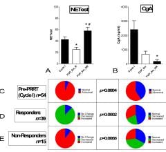 blood test, PRRT, neuroendocrine tumors, NETs, somatostatin receptor imaging, SRI, SNMMI 2016 study