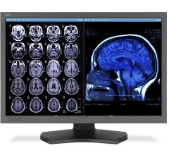 brain abnormalities, schizophrenia, MRI, ENIGMA, Jessica Turner, Theo van Erp