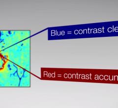 Brainlab Contrast Clearance Analysis Software Receives FDA 510(k) Clearance