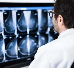 Study Suggests Breast Cancer Patients Forego Post-Surgery Treatment Due to Mistrust