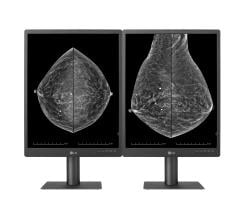 Addition of 21.3-inch High-Definition Mammography Monitor Helps Accelerate LG’s B2B Medical Device Business Growth