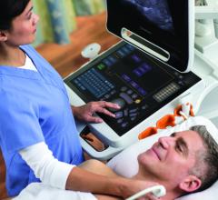 touch screen ultrasound, Carestream Touch