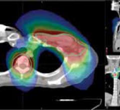 The TomoTherapy and CyberKnife Systems Highlight Quality of Care for Cancer Patients