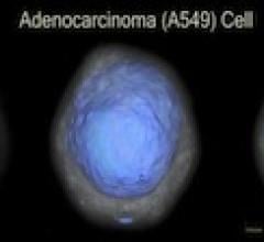 CT Lung cancer detection