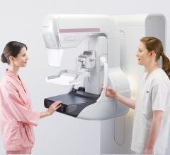 Aspire Cristalle Mammography System Fujifilm Medical Systems USA FDA Approval