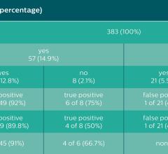 Results of the vertebrae-based analysis (383 vertebrae in 34 patients) for detection of BME.