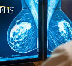 Candelis, Inc. recently launched the Advanced Breast Imaging Workstation as an enhancement to its ImageGrid platform