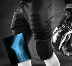 Carestream Supplies Wireless Digital X-ray Detectors for 2018 NFL Combine