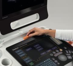 Carestream Receives Vizient Innovative Technology Designation for Touch Prime Ultrasound Systems