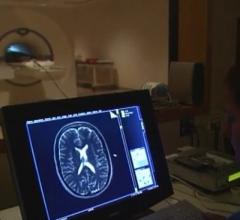 Children with Kidney Disease Show Blood Flow Changes in Brain