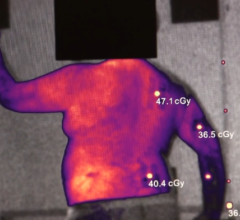 Cherenkov radiation imaging during radiation therapy