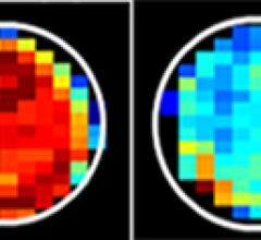 MRI, sugar, cancer cells, Johns Hopkins, Jeff Bulte, Xiaolei Song