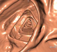 CT colonography, patient and provider groups, Congress, screening, H.R. 1298