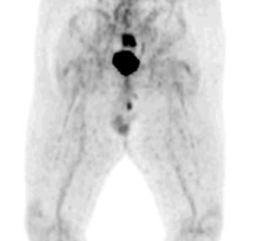 Radiopharmaceuticals and tracers radiation therapy journal of nuclear medicine