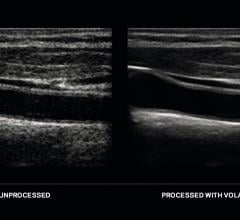 ContextVision Demonstrates VolarView and the Orthopedic Package at ECR 2018