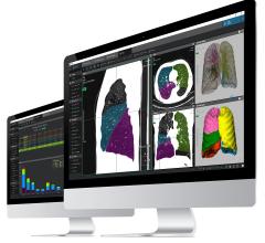 Coreline Soft Introduces AI Lung Segmentation Solution at RSNA 2018