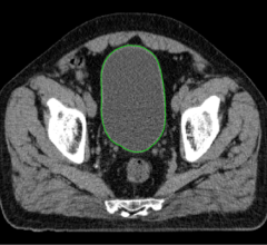 Bladder Abdomen Pelvis image with DLCExpert