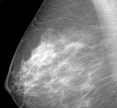 DenseBreast-info.org Celebrates Third Anniversary