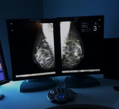 Survey Shows Dense Breast Reporting Laws Increase Breast Density Awareness