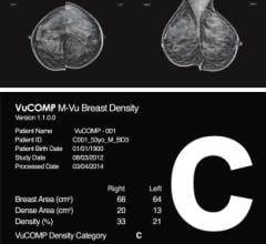 VuCOMP Mammography M-Vu Breast Density M-Vu Cad Turkey