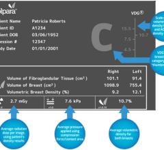 Clinical Trial/study, Mammography systems, Breast density, Volpara Solutions