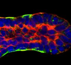 3-D Imaging and Computer Modeling Capture Breast Duct Development