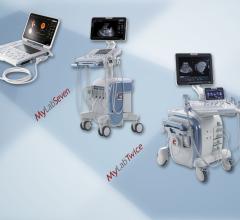 Esaote Launches Crystaline Ultrasound Technology at ECR 2014