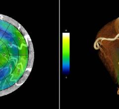 Fujifilm Introduces Artificial Intelligence Initiative for U.S. Market at RSNA 2017