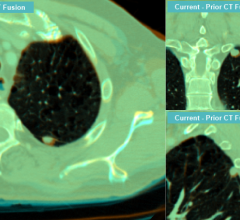 pacs accessories rsna 2013 blackford intelerad matchedcrosshairs inteleviewer