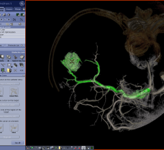 Flight Plan for Liver GE Healthcare RSNA 2012