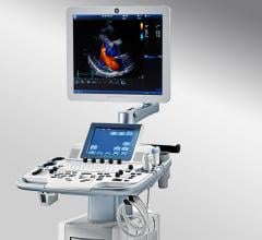 GE Vivid T8 Low Cost Cardiovascular Ultrasound