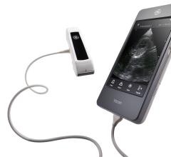 LVivo EF Cardiac Tool Now Available for GE Vscan Extend Handheld Mobile Ultrasound