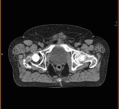 Zebra Medical Vision, USARAD, collaboration, imaging analytics platform, decision support algorithms, RSNA 2015