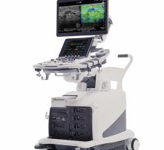 Hitachi Highlights Arietta 850 Premium Ultrasound System at RSNA 2017