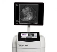 Hologic Launches Trident HD Specimen Radiography System