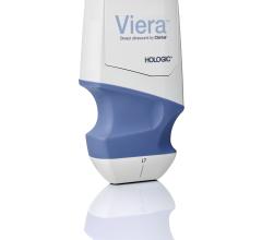 Hologic Announces Availability of Viera Portable Breast Ultrasound System