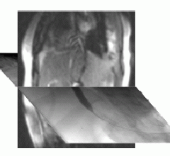 Hybrid Imaging Systems are the Focus at MEDICA 2010 