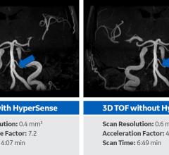  Hyper Sense Feature.