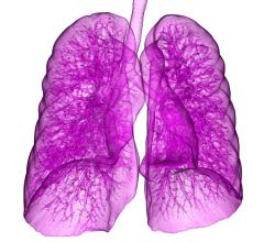 Non-small cell lung cancer, NSCLC, post-operative radiation therapy, PORT