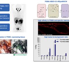 Dual-labeled PSMA-inhibitors for the diagnosis and therapy of prostate cancer