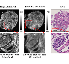 Comparisons of high definition and standard definition infrared imaging for digital histopathology. Image courtesy of the Beckman Institute