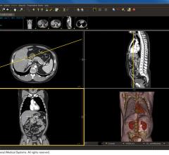 Intelerad, Laurel Bridge Software, partnership, enterprise imaging