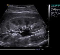 Portable Ultrasound Could Improve Kidney Disease Care for Former Prison Inmates