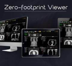 Exa PACS Helps Teleradiology Provider Increase Productivity 400 Percent