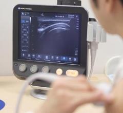 Konica Minolta Launches Sonimage MX1 Portable Ultrasound System