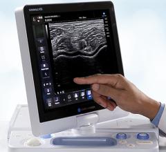 Konica Minolta Releases Sonimage HS1 Ultrasound Software Upgrade