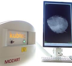 Kubtec Introduces Automatic Specimen Alert to Mozart 3-D Tomosynthesis System