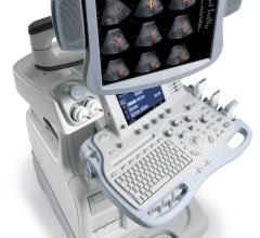 Alpha Source, data study, ultrasound equipment, total cost of ownership